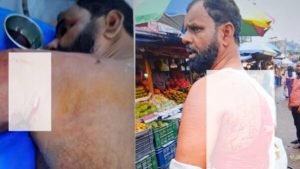 রক্তাক্ত শরীরেও ছিনতাইকারীদের পিছু ধাওয়া: বরিশালে ব্যবসায়ীকে কুপিয়ে দুই লাখ টাকা ছিনতাই