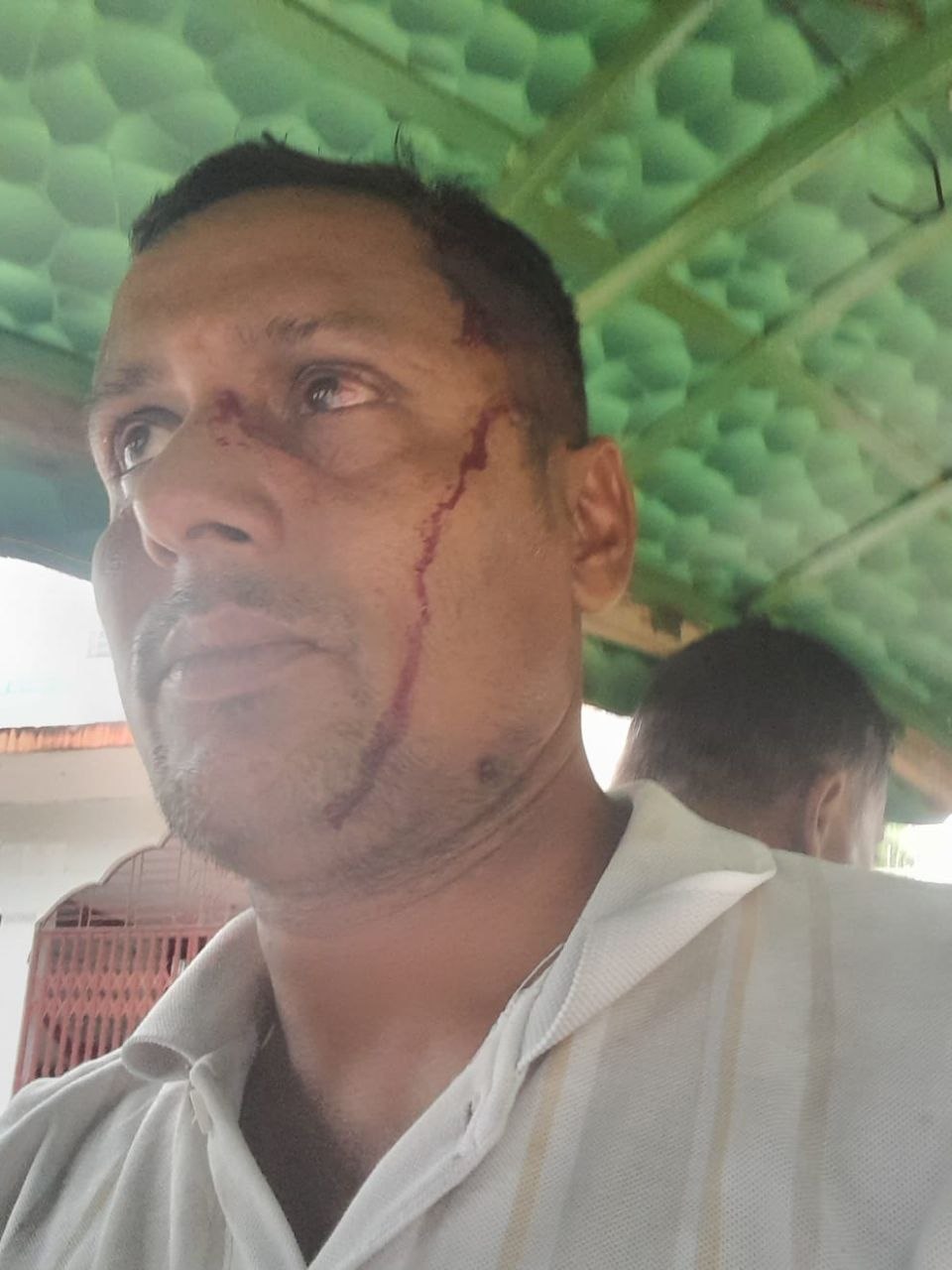 বানারীপাড়ায় কৃষক দলের সাধারণ সম্পাদক সুমনের ওপর হামলার অভিযোগ
