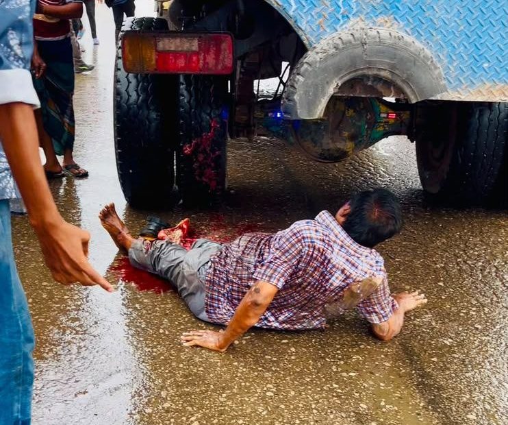 মেয়েকে পরীক্ষাকেন্দ্রে রেখে সড়ক পার হওয়ার সময় ট্রাকের চাপায় পা হারালেন বাবা